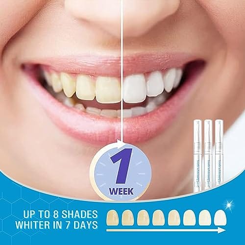 Teeth Whitening Kit Fithope