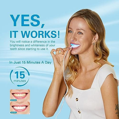 Pinfriy®  Teeth Whitening Kit